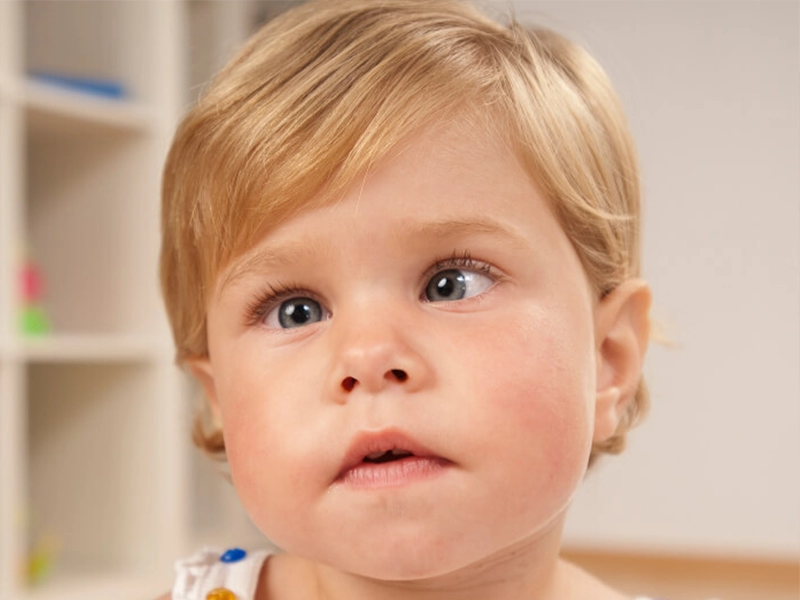 جراحی انحراف چشم