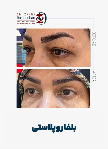 نمونه کار دکتر زهرا دست برهان