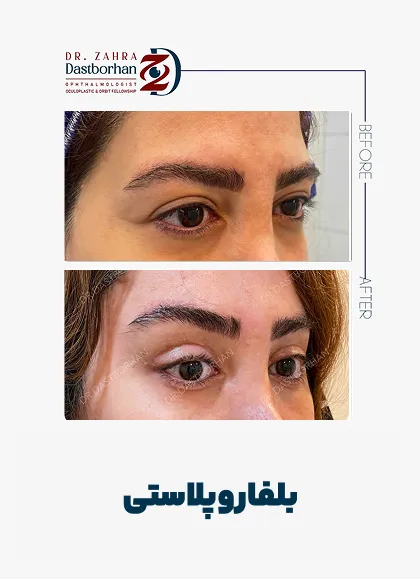 نمونه کار دکتر زهرا دست برهان