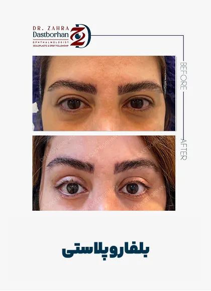 نمونه کار دکتر زهرا دست برهان