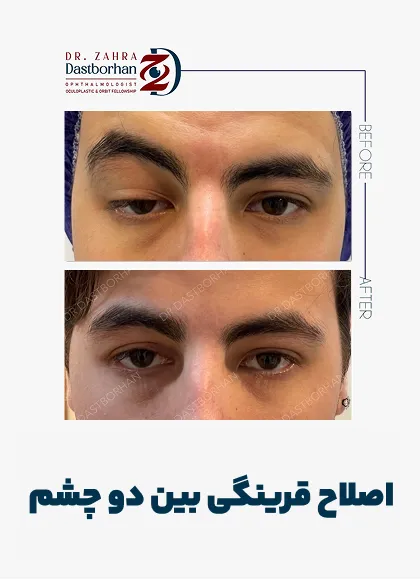 نمونه کار دکتر زهرا دست برهان