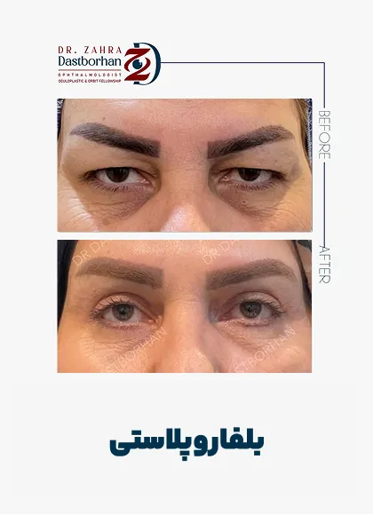 نمونه کار دکتر زهرا دست برهان