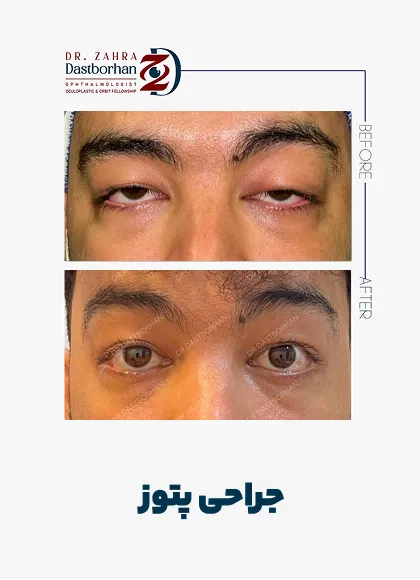 نمونه کار دکتر زهرا دست برهان