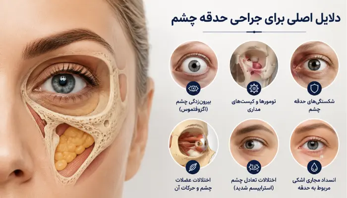 دلایل اصلی برای جراحی حدقه چشم