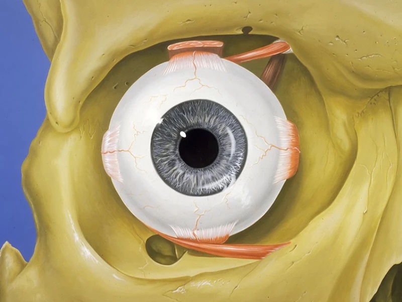 جراحی حدقه چشم