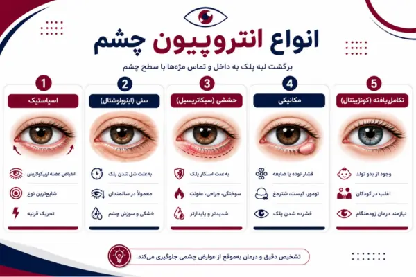 انواع انتروپیون چشم