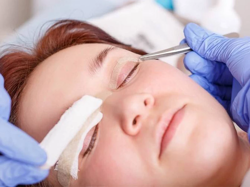 عمل ترمیمی پلک