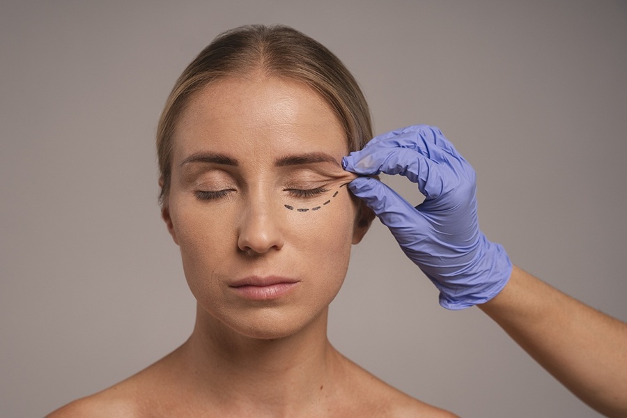 بهترین جراحی پلک