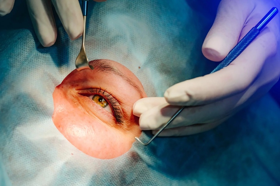 جراحی چشم
