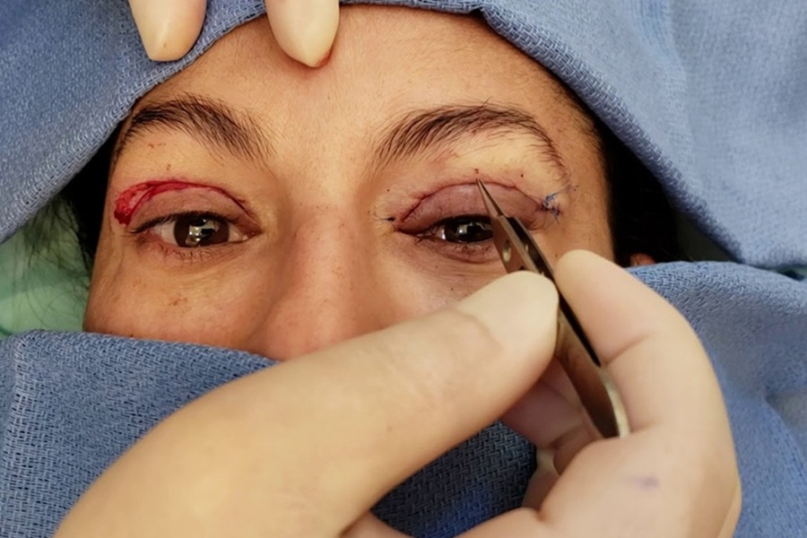 مراقبت‌های کلیدی برای یک نتیجه ایده‌آل