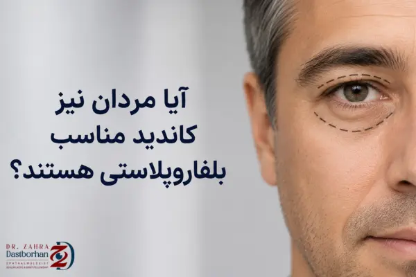 آیا مردان نیز کاندید مناسب بلفاروپلاستی هستند؟