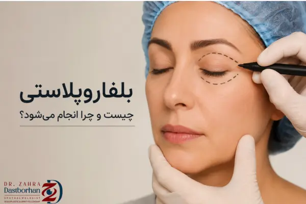 بلفاروپلاستی چیست و چرا انجام می‌شود؟