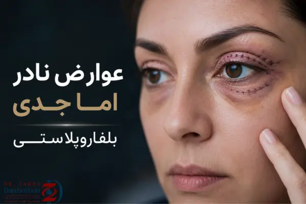 عوارض نادر اما جدی بلفاروپلاستی