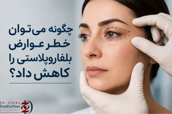 چگونه می‌توان خطر عوارض بلفاروپلاستی را کاهش داد؟