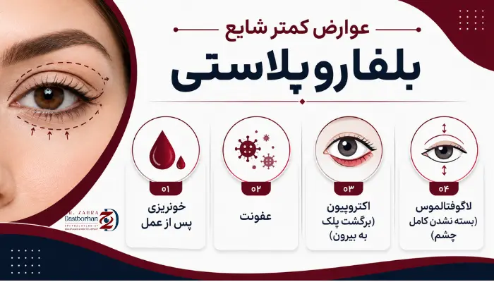 عوارض کمتر شایع بلفاروپلاستی