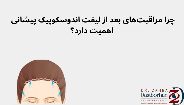  چرا مراقبت‌های بعد از لیفت اندوسکوپیک پیشانی اهمیت دارد؟