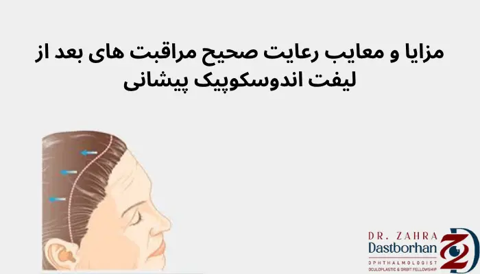 مزایا و معایب رعایت صحیح مراقبت های بعد از لیفت اندوسکوپیک پیشانی