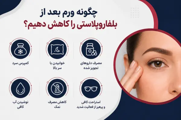چگونه ورم بعد از بلفاروپلاستی را کاهش دهیم؟