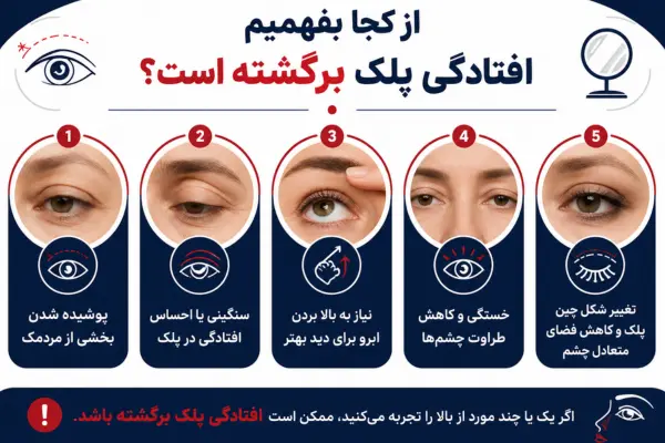 از کجا بفهمیم افتادگی پلک برگشته است؟