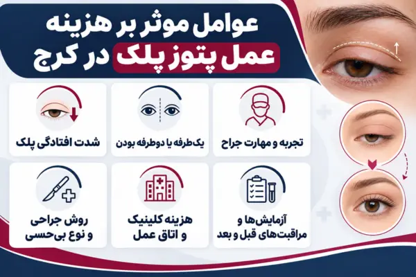 چه عواملی روی هزینه عمل پتوز پلک در کرج تاثیر میگذارند؟
