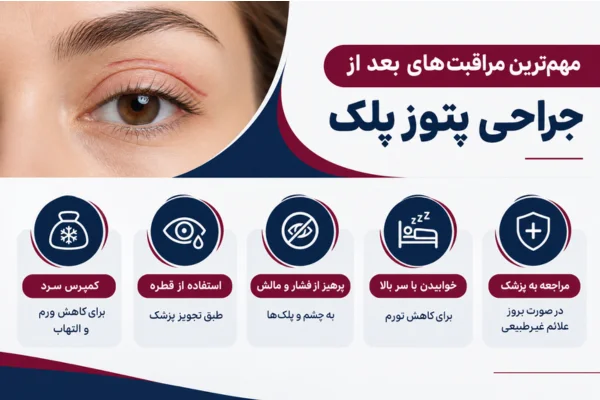 مهم‌ترین مراقبت‌های بعد از جراحی پتوز پلک