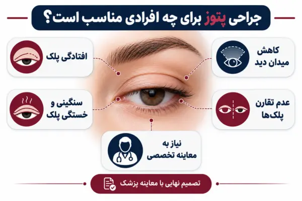 جراحی پتوز برای چه افرادی مناسب است؟